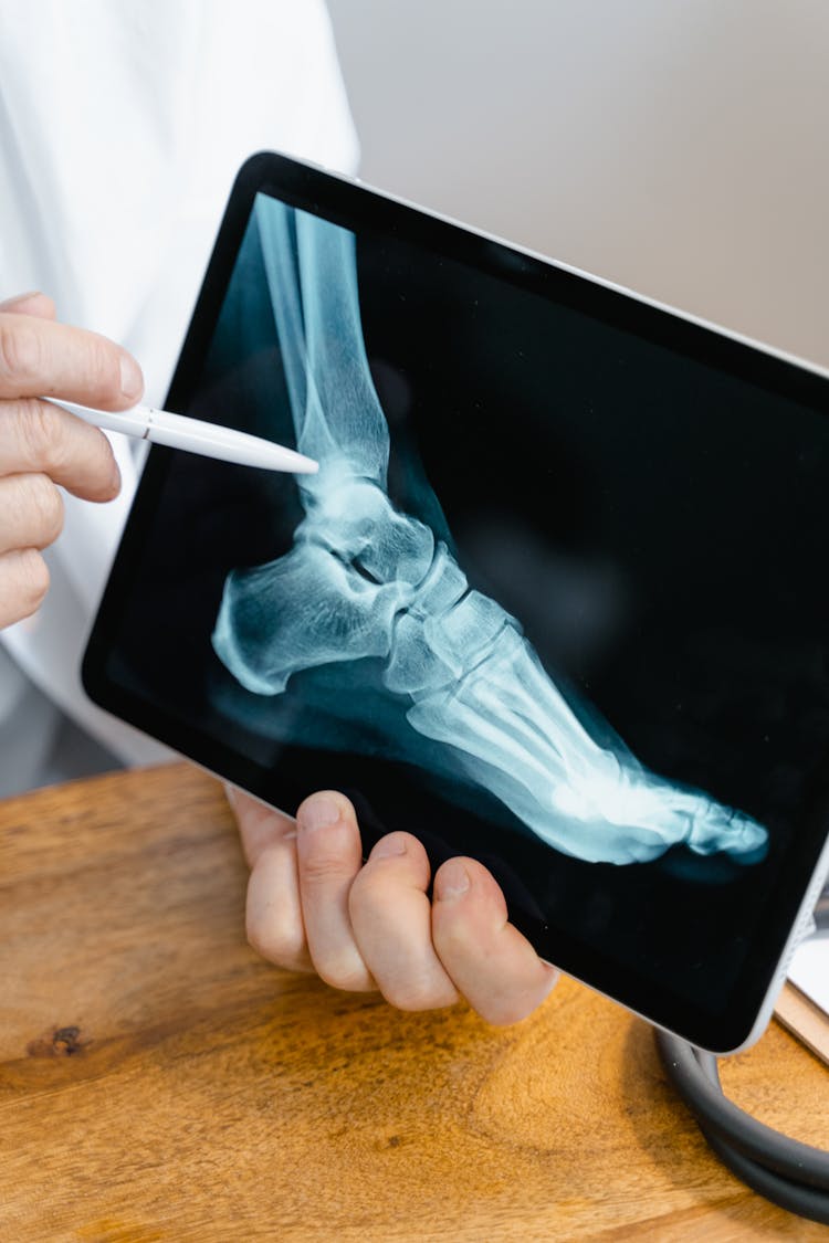 Close-Up Shot Of A Doctor Showing The Result Of An X-Ray On Tablet Computer
