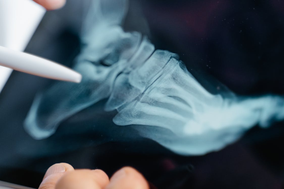 Ingyenes stockfotó betegellátás, betegszűrés, csendélet témában Stockfotó