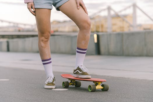 A young skater wearing denim shorts and striped socks rides a skateboard on a city street.