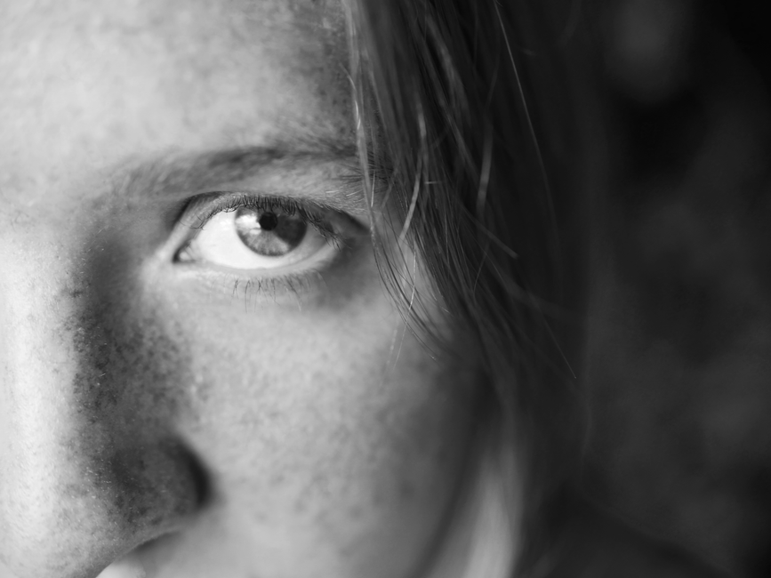 Black-and-white close-up of a woman's eye and part of her face with freckles, creating an intimate portrait.