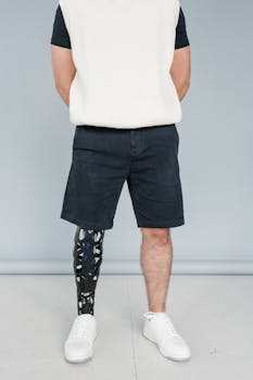 Man standing in shorts with high-tech prosthetic leg, showcasing modern design.