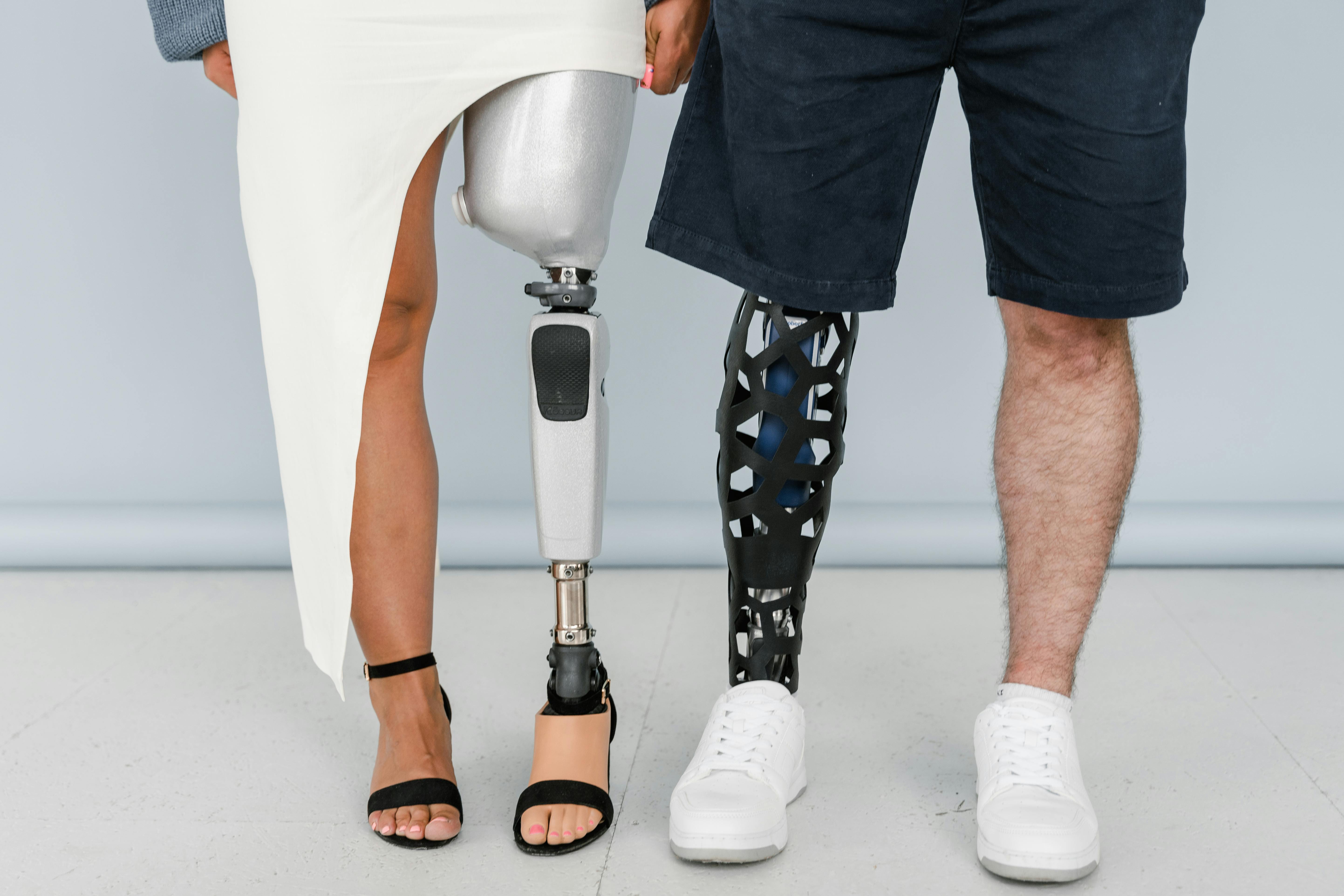 A Man and a Woman with Prosthetic Legs Standing Together · Free