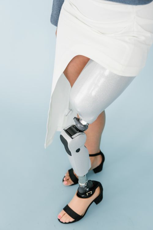 Person with prosthetic leg walking confidently