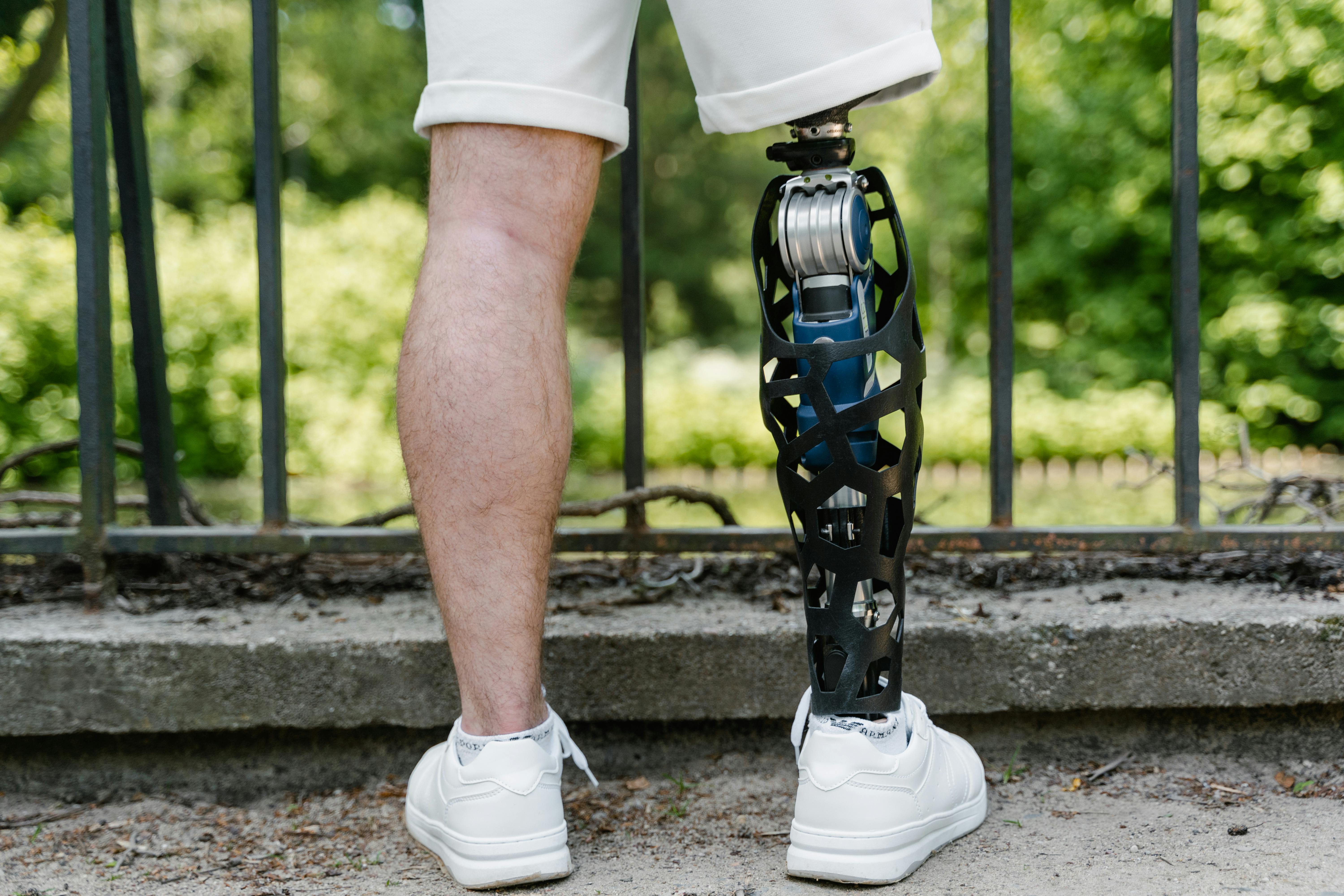 Photo Of Man Wearing Prosthetic Leg · Free Stock Photo