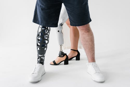 People with Prosthetic Legs Standing Near Each Other in Close-up Photography