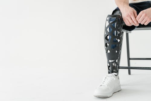 Man with a Bionic Prosthetic Leg in a 3D Printed Cover