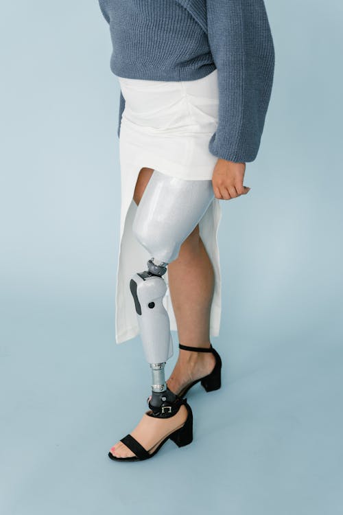 A Person with Prosthetic Leg