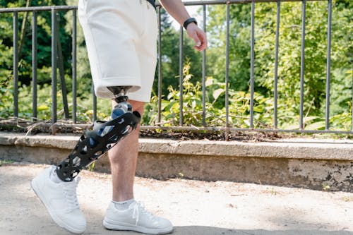 A Person with Prosthetic Leg