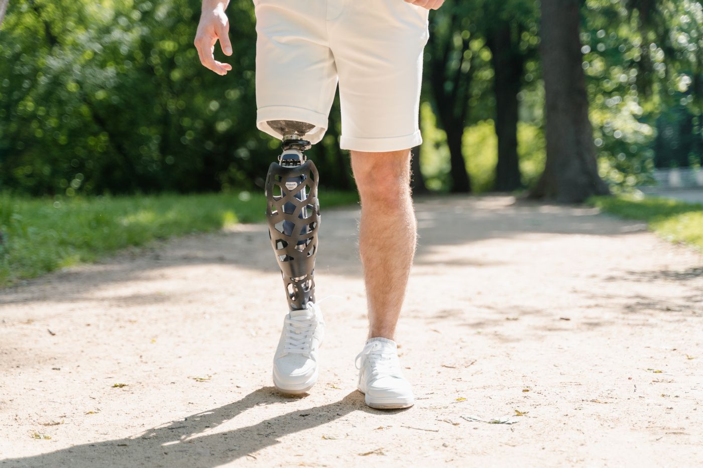 Close-up of a man walking outdoors with a prosthetic leg after limb loss