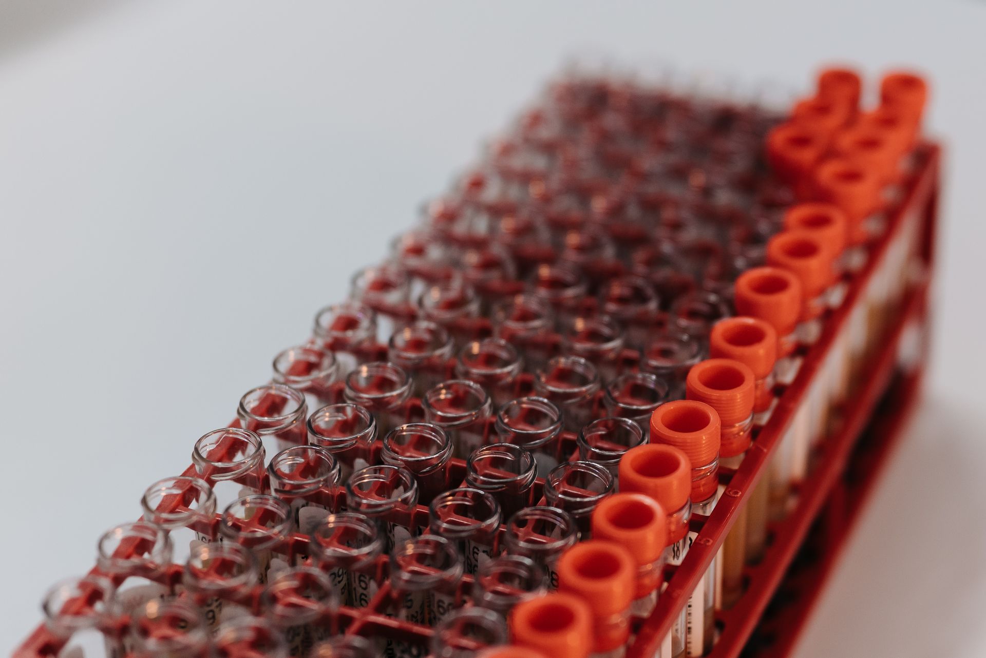 Tubos de muestras de sangre en un estante de laboratorio