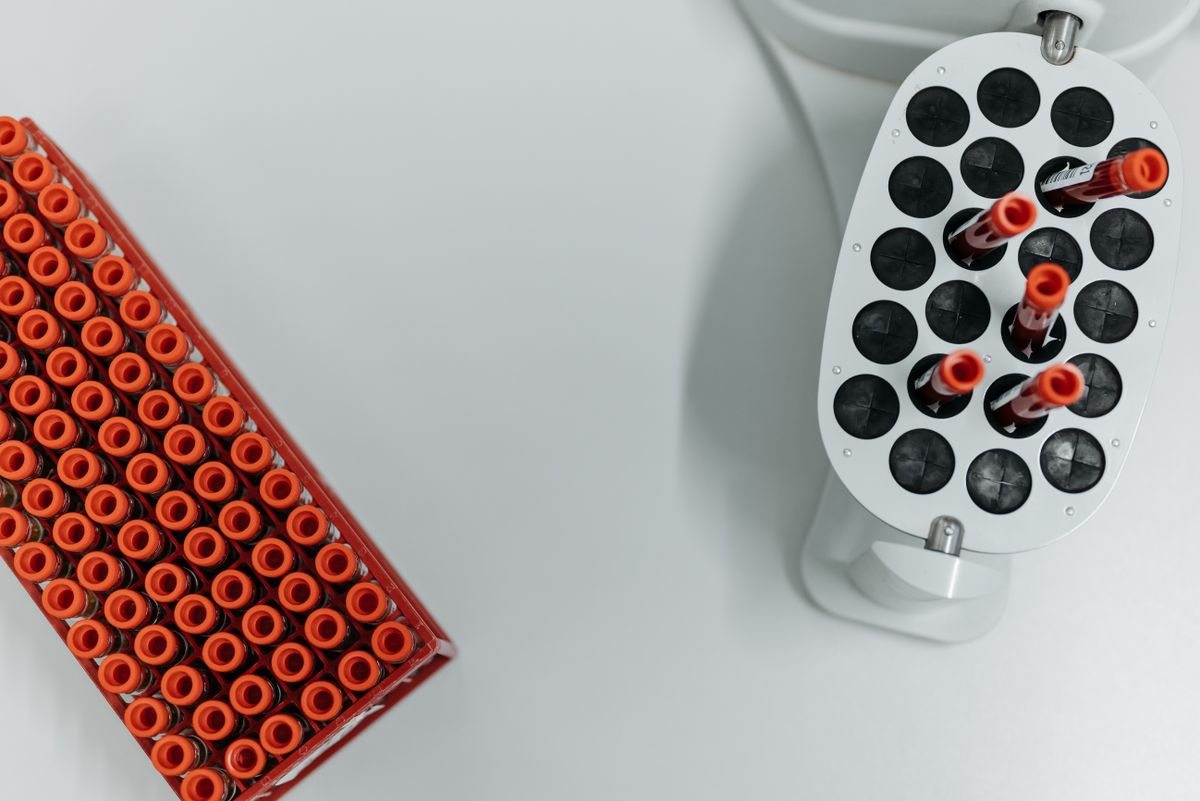 Overhead view of capped sample tubes in a rack beside a bench centrifuge — photo by Pavel Danilyuk on Pexels