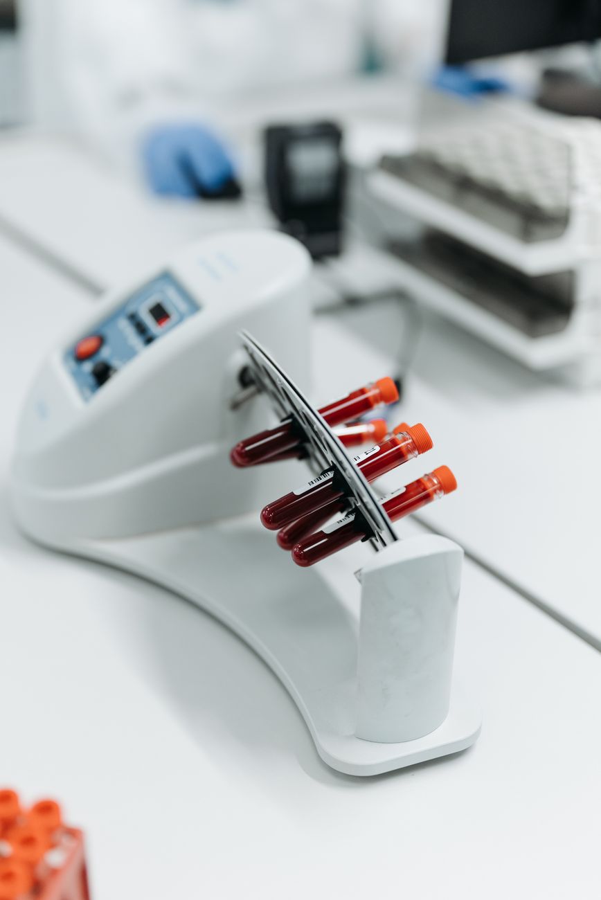 Blood samples prepared for plasma proteomics analysis in a research laboratory.