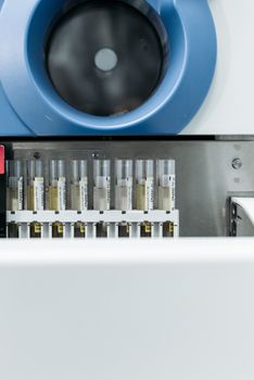 Detailed view of test tubes in laboratory equipment for medical testing.