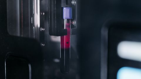 A detailed view of a blood sample test tube inside a laboratory machine, highlighting medical research.