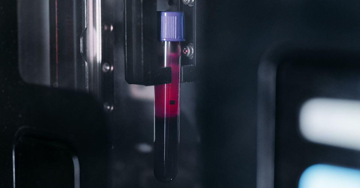 Blood Sample in a Tube for Test