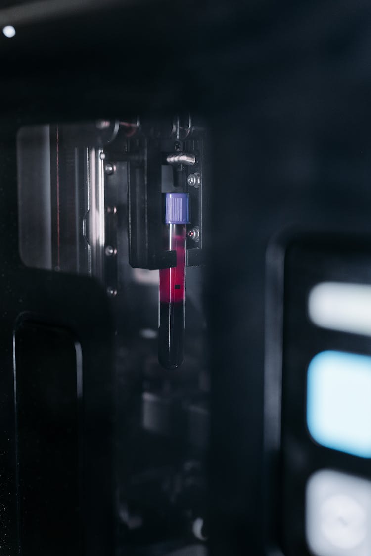 Blood Sample In A Tube For Test