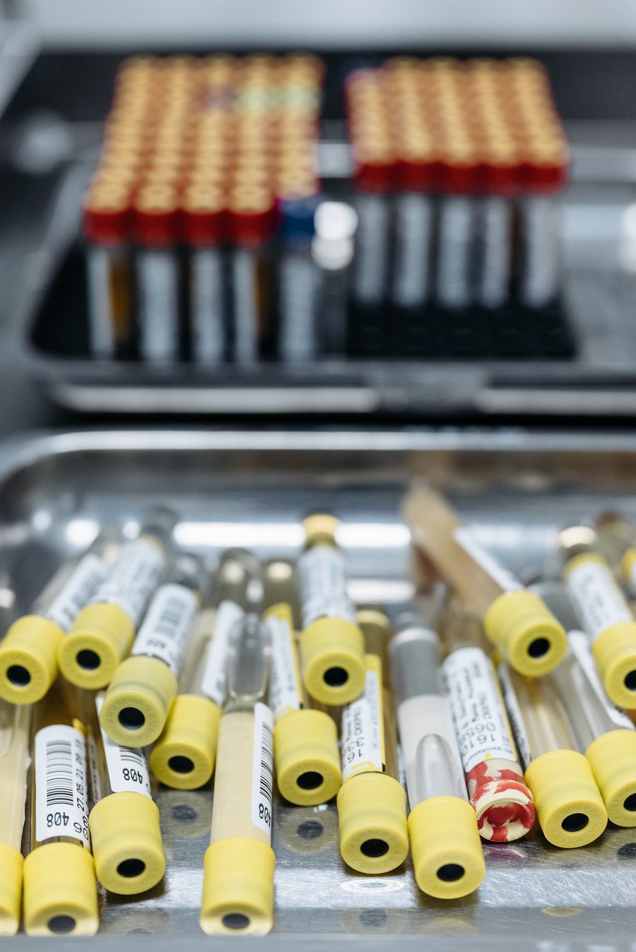 Medical laboratory test tubes prepared for analysis