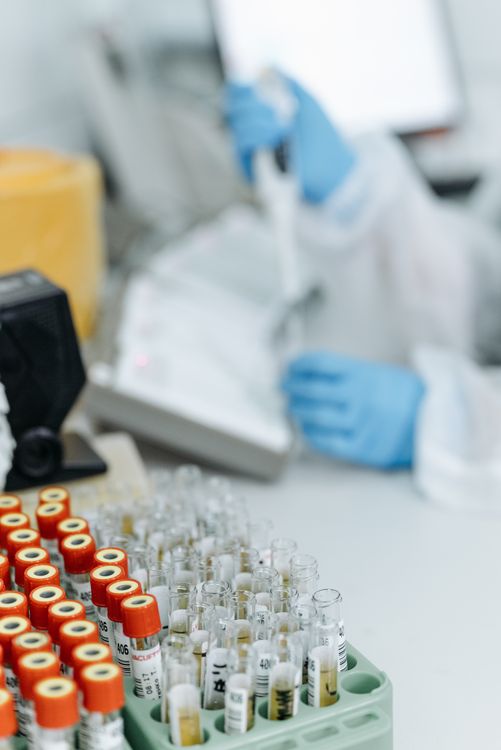 Istraživač koristi pipetu za analizu uzoraka krvi u laboratoriju