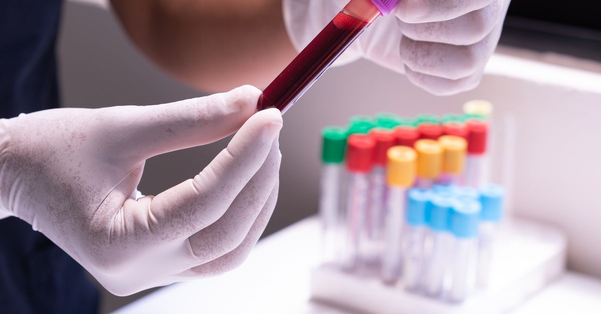 Bayer y Hurdle Colaboran para Impulsar la Salud de Precisión