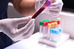 A healthcare worker examines a blood sample in test tubes, emphasizing medical precision and care.