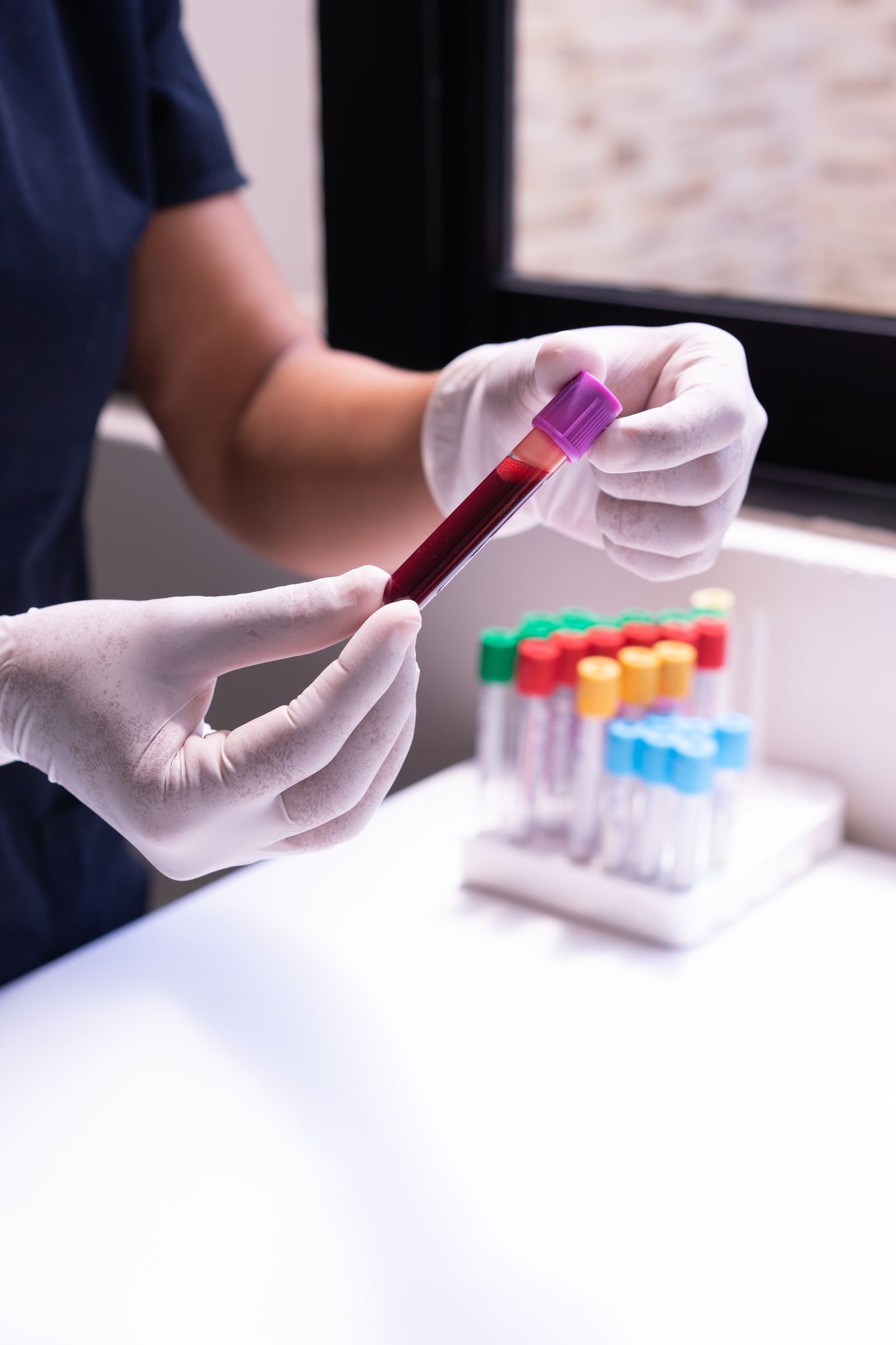 Private blood testing at Harrow Clinics for Harrow residents