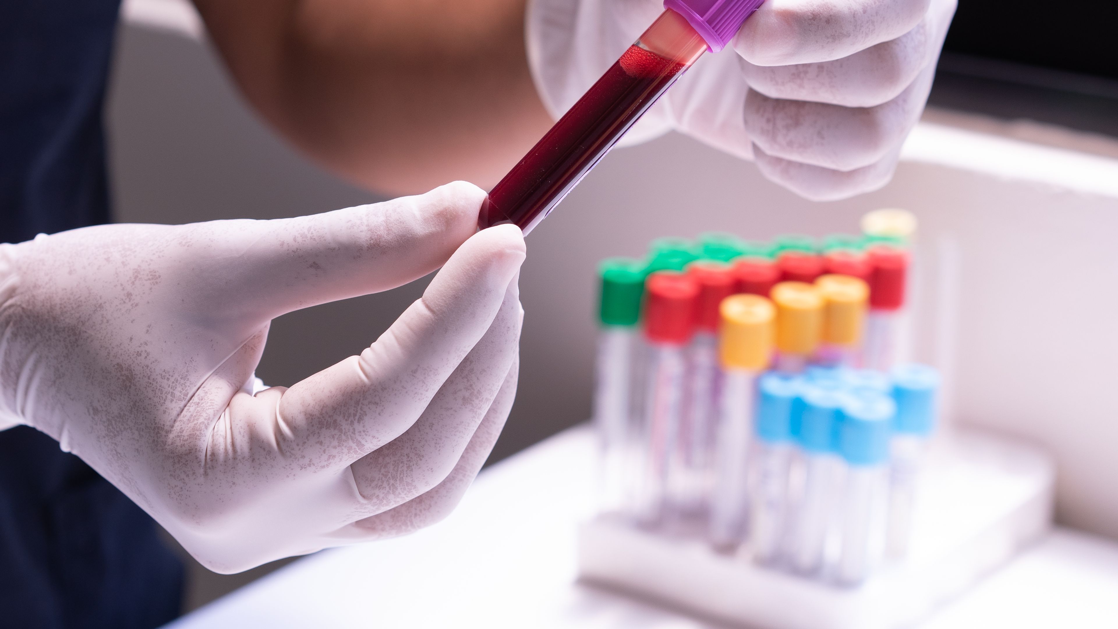 Person holding a blood sample in a clinical test tube for delta check verification