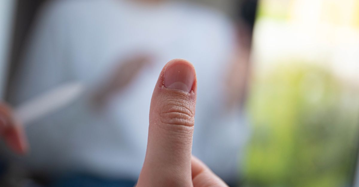 UCL Tear in Thumb: From Diagnosis to Recovery Guide 2026 3 Detailed view of a thumb with a blurred background, showcasing texture and focus. - ucl tear in thumb