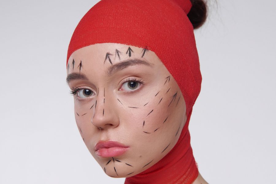 Facelift