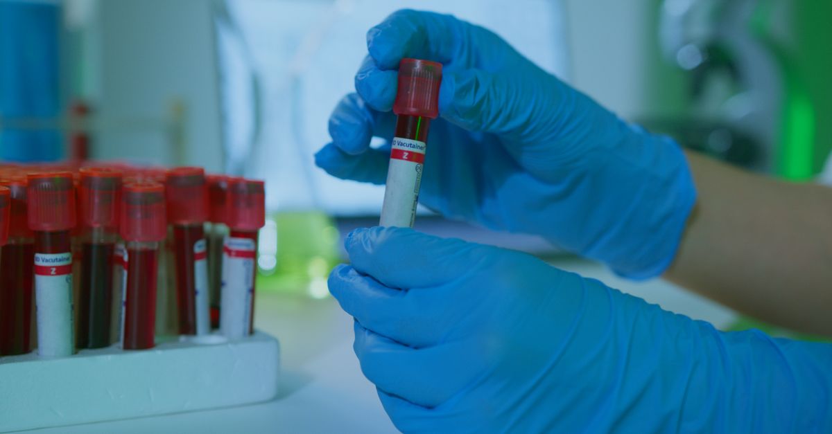 Thyrocare Promoter Docon Sells 9.9% Stake for Rs 986 Crore