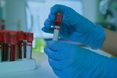 A detailed view of gloved hands holding blood vials in a lab setting, illustrating medical research.