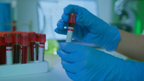 A detailed view of gloved hands holding blood vials in a lab setting, illustrating medical research.