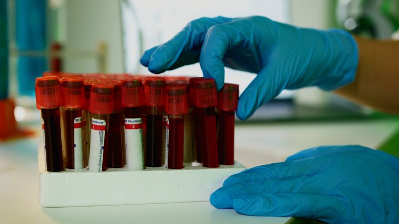 Akdeniz Üniversitesi'nde CAR-T tedavisine 9 hastayla başlandı