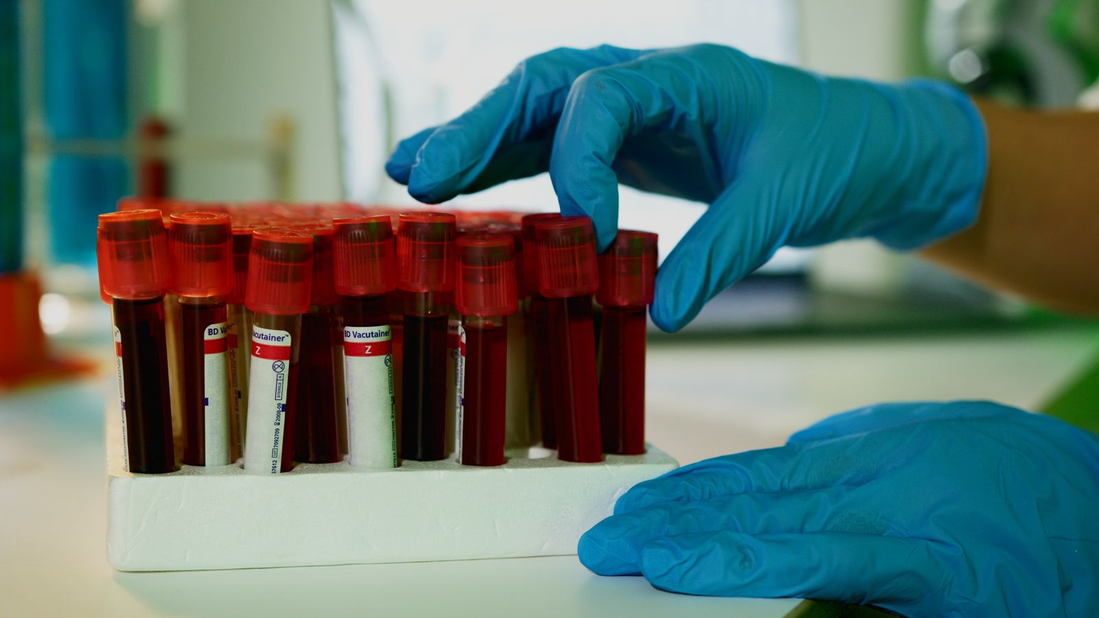 Root-cause medicine: how we investigate symptoms when standard labs come back normal