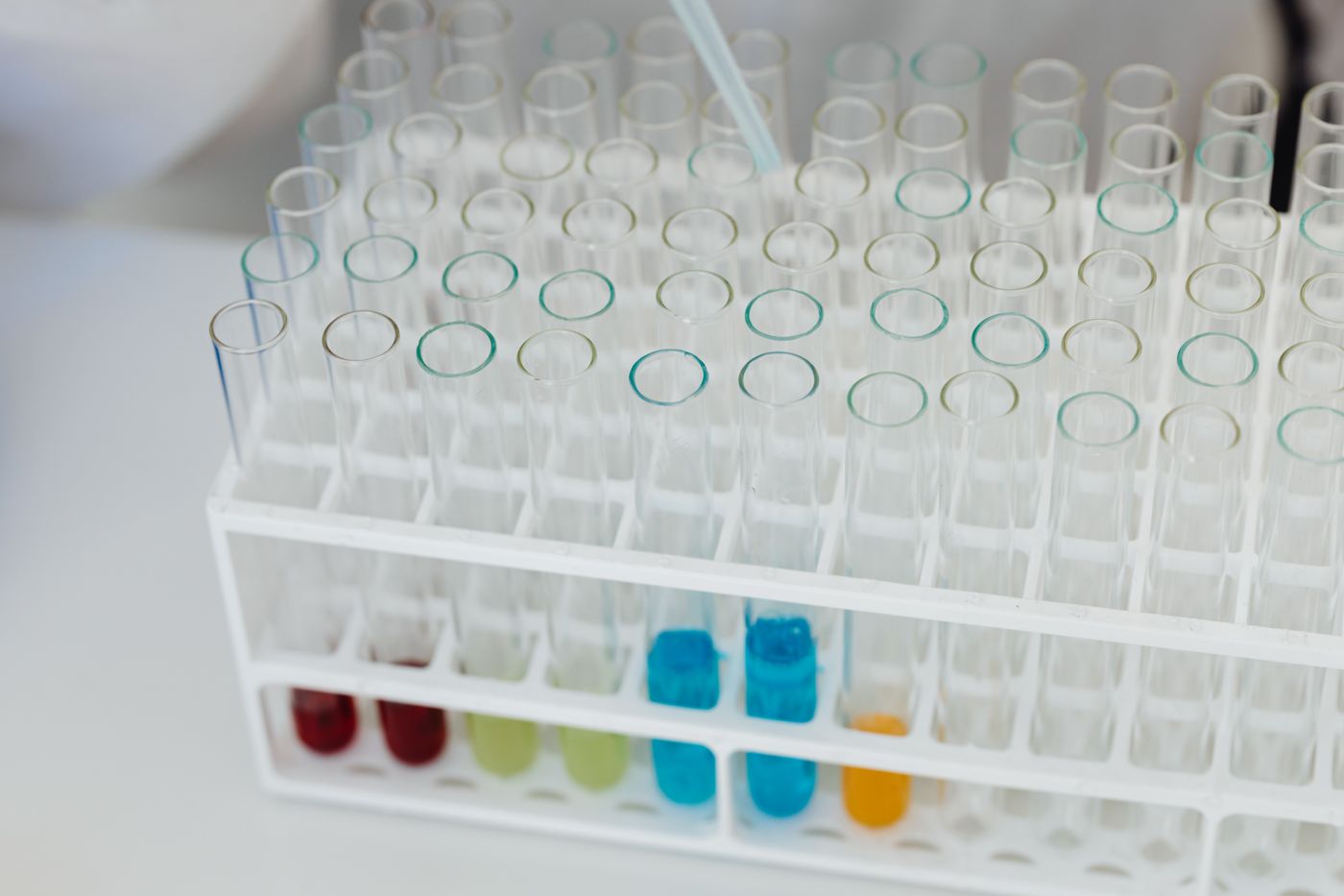 Laboratory test tubes in a rack