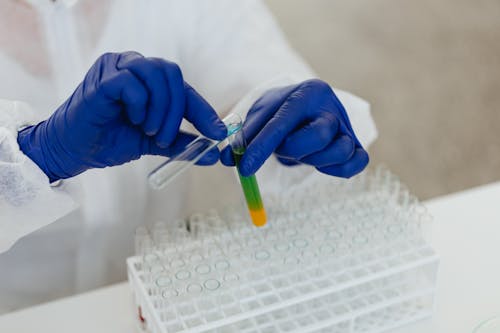 Free A Person Wearing Blue Gloves while Holding Test Tubes with Liquid Stock Photo