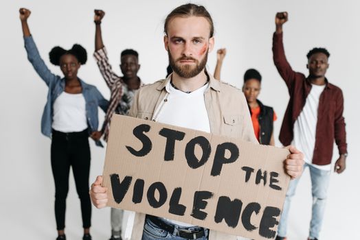Man with Bruise on Cheek Holding 'Stop the Violence' Poster