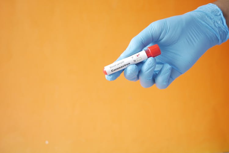 A Person Holding A Vacutainer