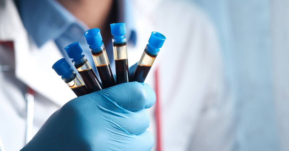 multiple myeloma