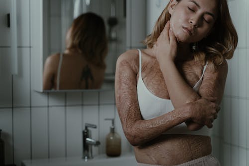 Foto profissional grátis de cicatrizes de queimadura, cobertura, mulher