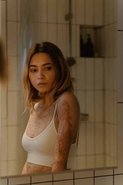 Free A woman with burn scars gazes at her reflection in a bathroom mirror, conveying strength and resilience. Stock Photo