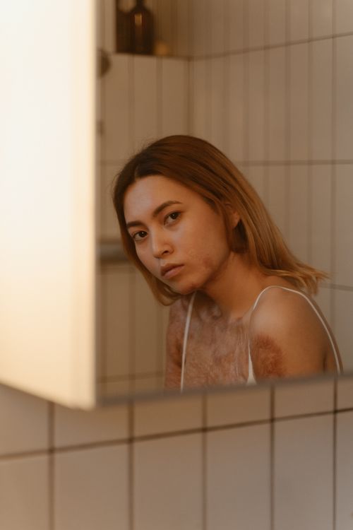 Free Artistic portrait of a woman with scars reflected in a bathroom mirror, highlighting self-acceptance. Stock Photo