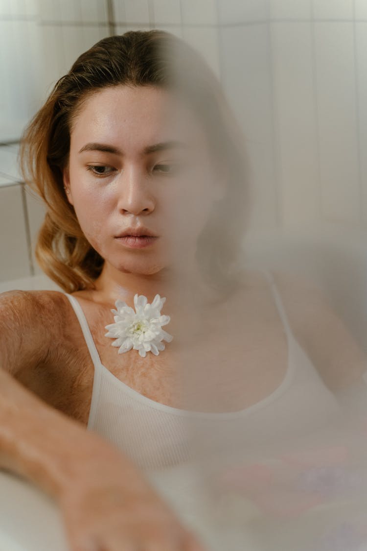 A Woman In A White Spaghetti Strap Top With Burn Scars 