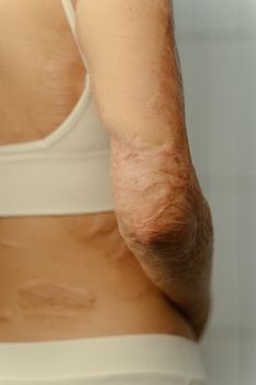 Exosomes for Wound Healing: The Science of Tissue Regeneration