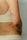 scars