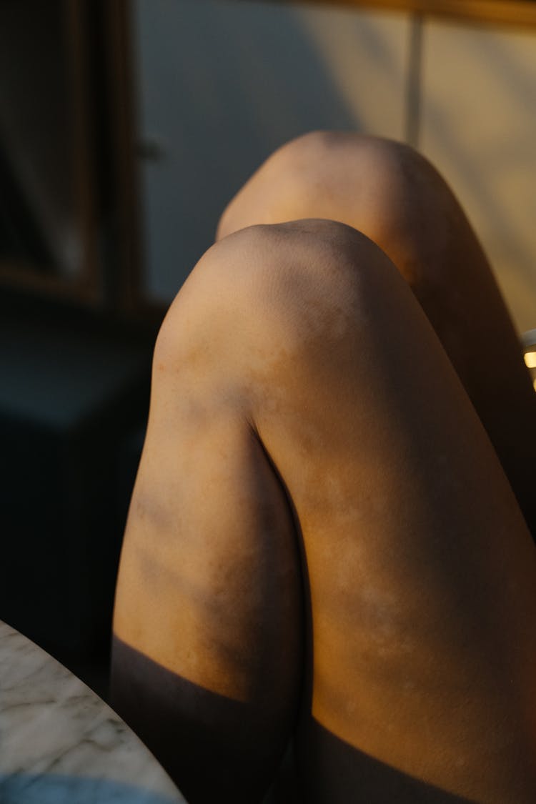 Close Up Photo Of Folded Knees