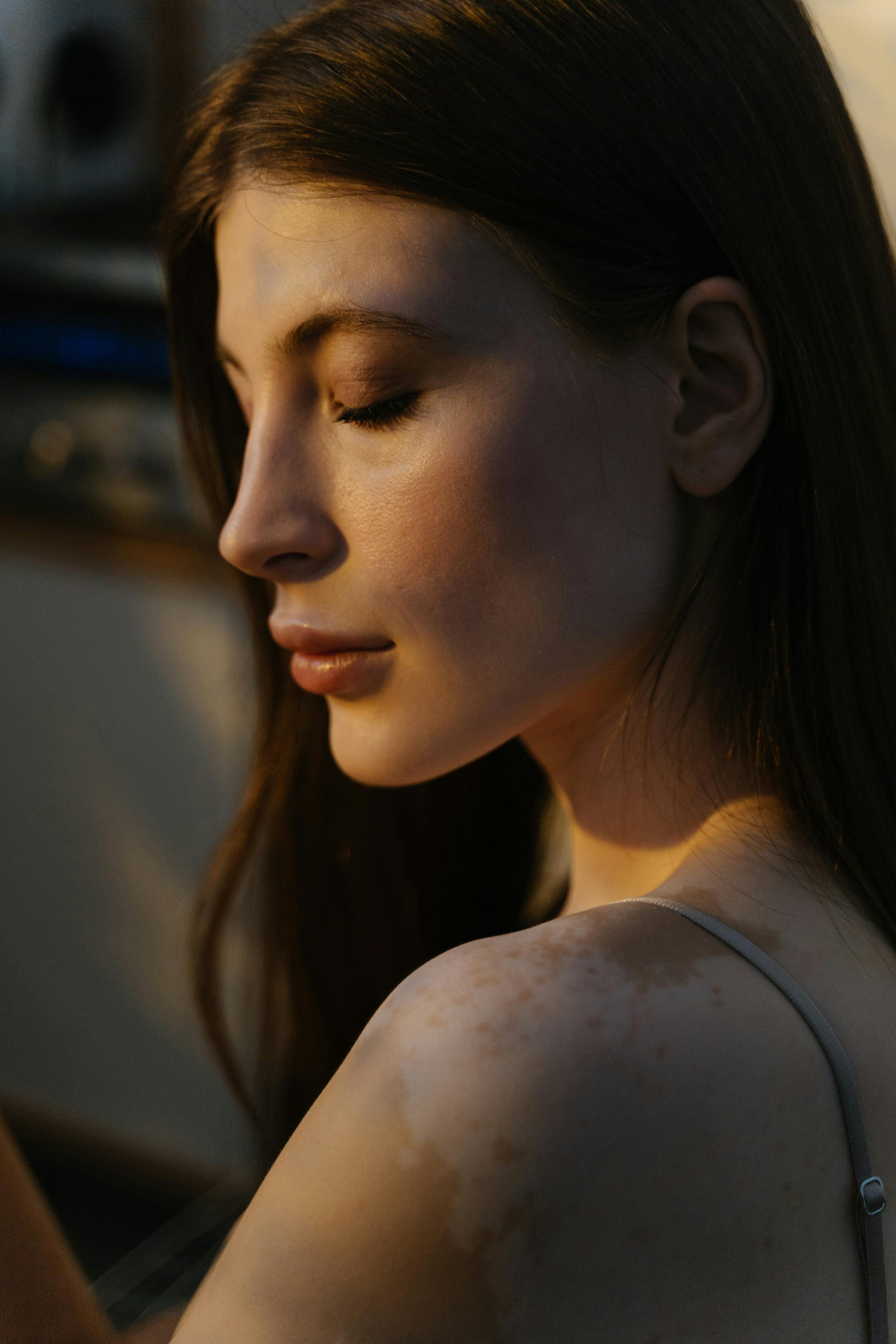 Elegant portrait capturing the natural beauty of a woman embracing her vitiligo.
