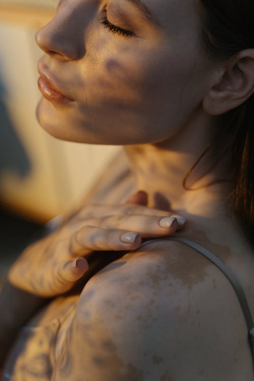 คลังภาพถ่ายฟรีของ hypopigmentation, การเปลี่ยนสีผิว, ร่างกายในเชิงบวก, โรคด่างขาว, ใกล้ชิด, ไหล่ คลังภาพถ่ายฟรีของ Hypopigmentation, การเปลี่ยนสีผิว, ร่างกายในเชิงบวก, โรคด่างขาว, ใกล้ชิด, ไหล่