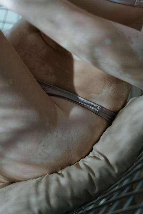 Darmowe zdjęcie z galerii z bielactwo, ciało pozytywne, hipopigmentacja
