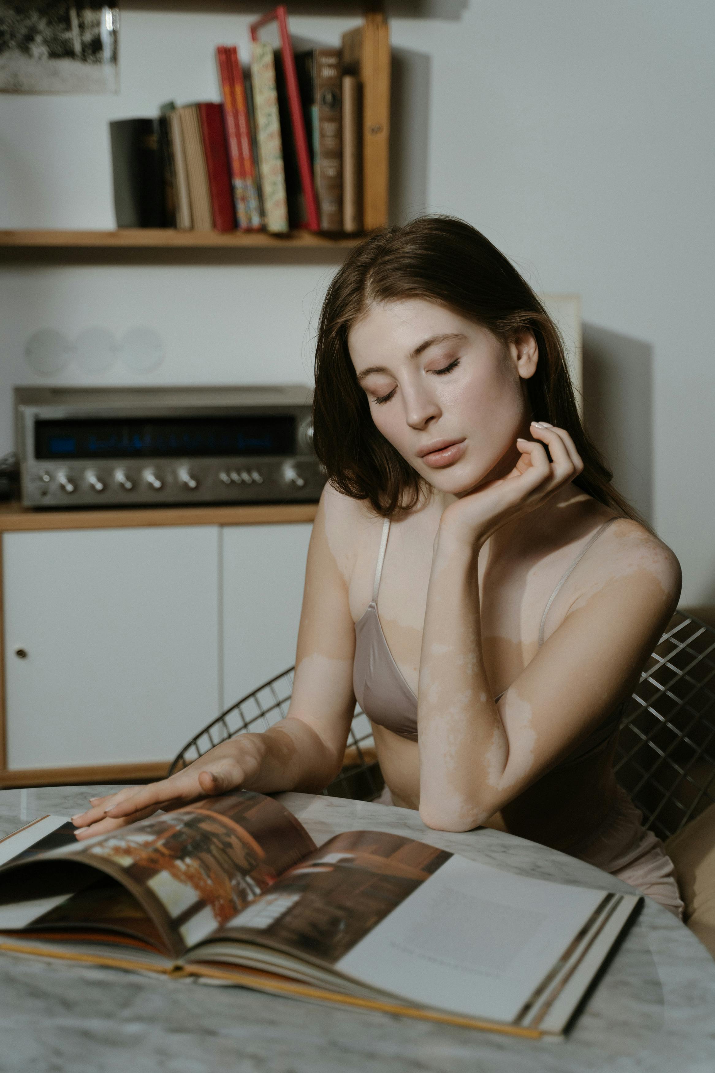 A woman with vitiligo calmly reading a book at home, showcasing self-reflection and tranquility.