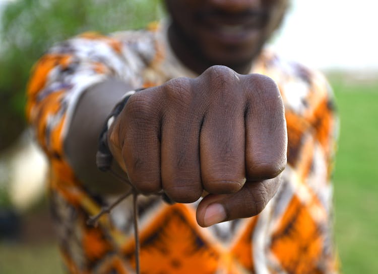 A Man Showing His Fist And Knuckles